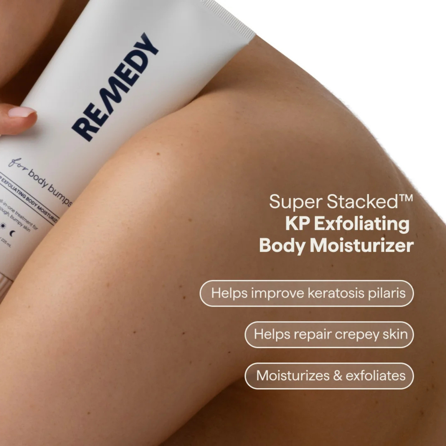 REMEDY For Body Bumps Exfoliating Body Moisturiser