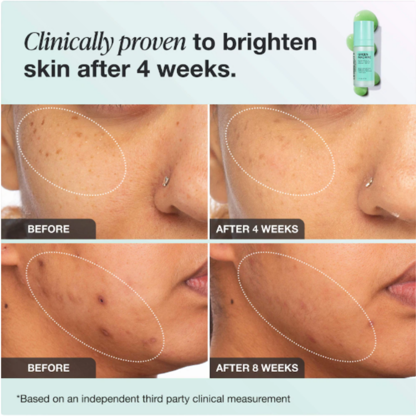 iNNBEAUTY PROJECT - Green Machine Vitamin C Dark Spot & Hyperpigmentation Serum